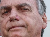 Bolsonaro apresenta piora clínica e vai passar por novos exames