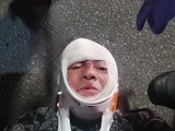 Baterista da Fantasma Rock é atropelado em Maceió.