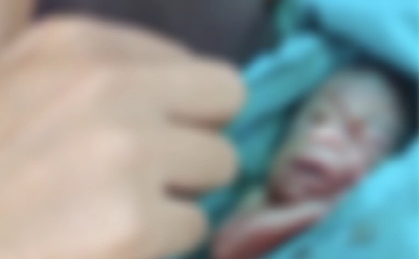 bebê prematuro dado como morto, chora durante sepultamento no Acre