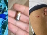 Ex-dirigente do ASA é atingido por bala perdida em lanchonete de Arapiraca