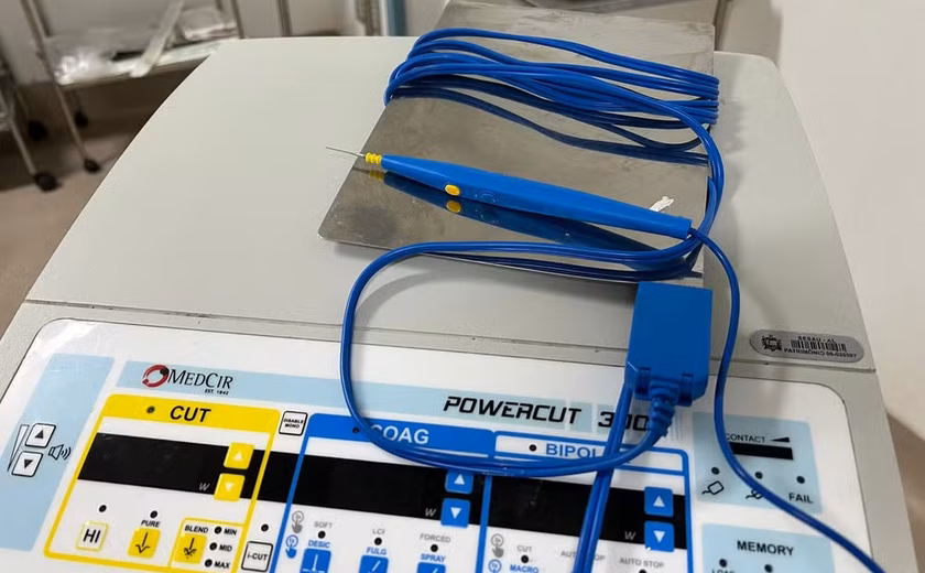 Hospital em Maceió diz que éter provocou queimaduras em idoso durante cirurgia com bisturi elétrico