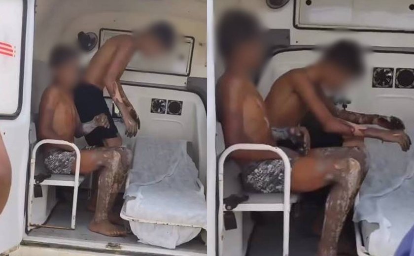 Dois adolescentes sofrem queimaduras graves após acidente com fogos em Ibateguara