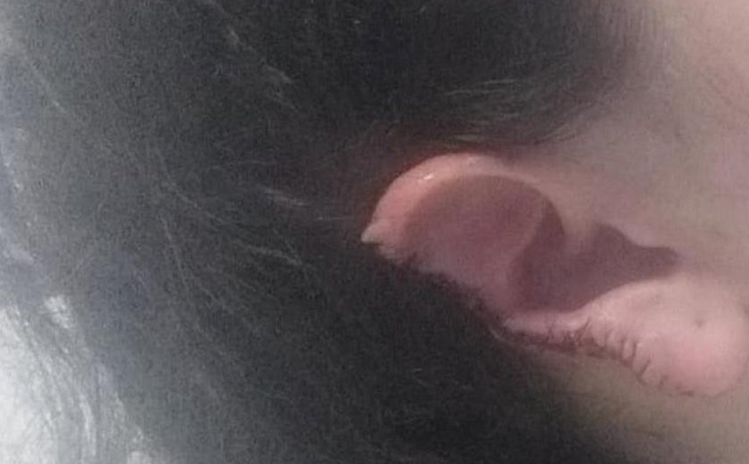Mulher tem parte da orelha arrancada em ataque do marido em Primavera do Leste