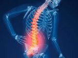 Diagnóstico tardio da osteoporose em homens prejudica tratamento