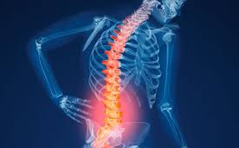 Diagnóstico tardio da osteoporose em homens prejudica tratamento