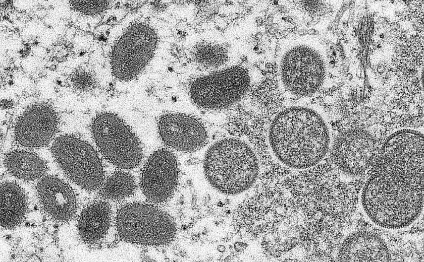 Brasil registra terceiro caso de varíola dos macacos
