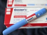 Rosto de Ozempic: remédio muda a qualidade da pele das pessoas?