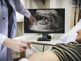 Aborto legal: TJ suspende lei que obriga mulher a ver imagem de feto