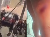Abordagem policial termina com uma criança e duas adolescentes baleadas em Maceió