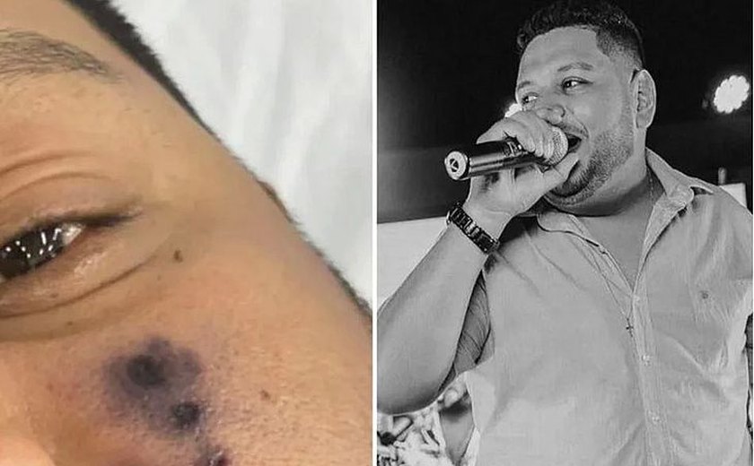 Cantor de forró morre após picada de aranha, diz família; rosto do homem começou a escurecer