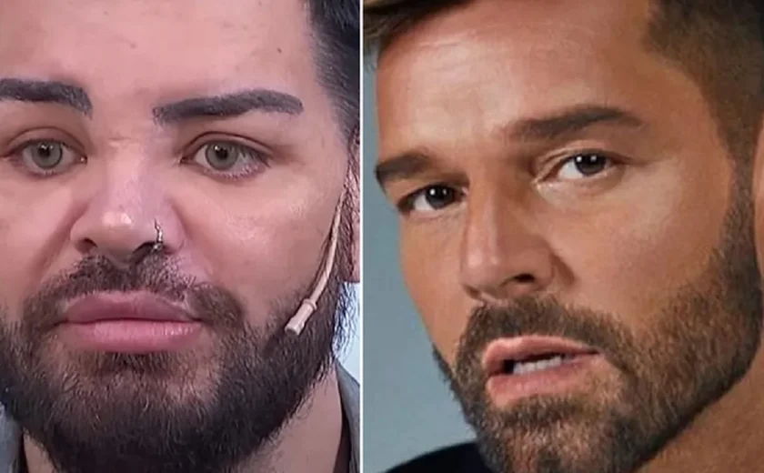 Ator faz 30 cirurgias plásticas para se parecer com Ricky Martin