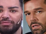 Ator faz 30 cirurgias plásticas para se parecer com Ricky Martin