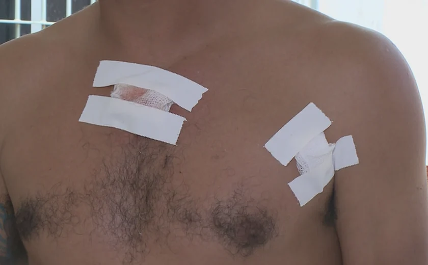 Tiro de agente da SMTT acertou placa de platina no corpo de homem; 'Quero que ele pague', diz vítima