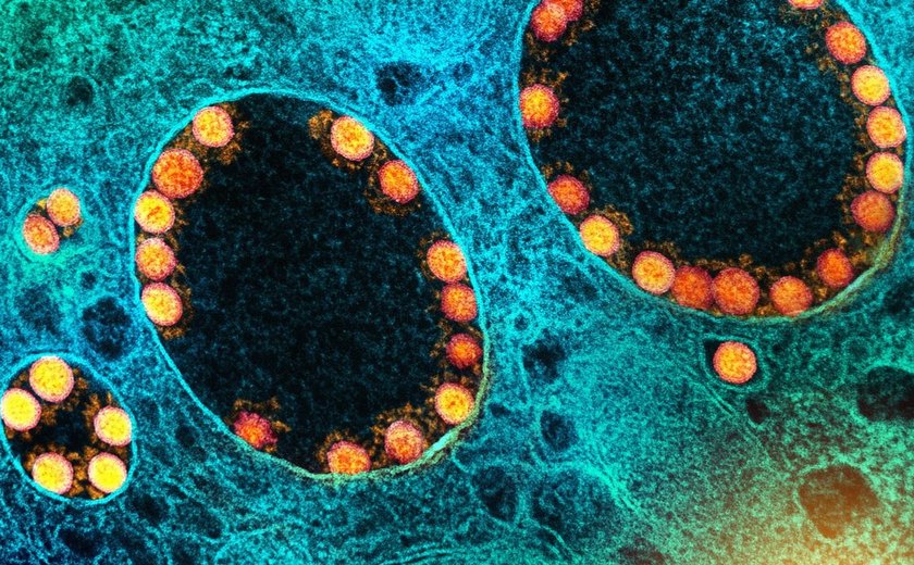 Todos os seis brasileiros que pegaram ômicron já tinham sido vacinados e têm sintomas leves