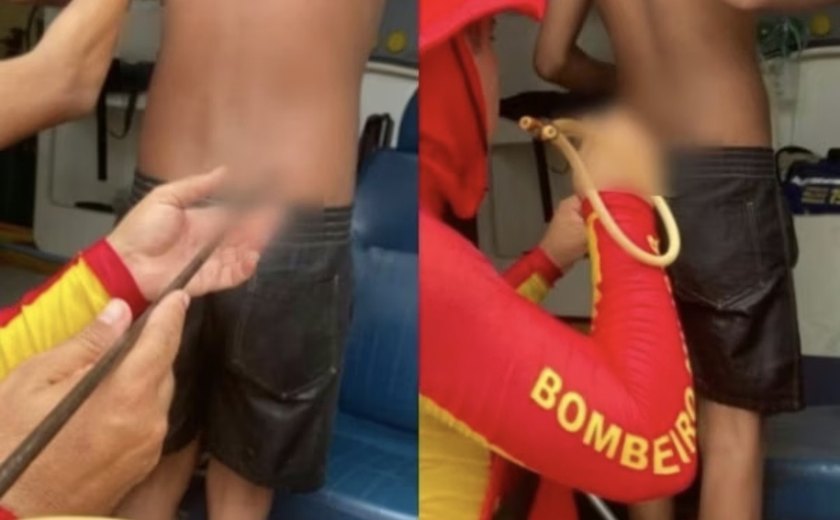 Adolescente é atingido por arpão na nádega durante pesca na Praia do Francês