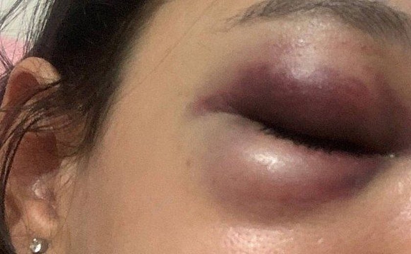 Estudante é agredida após reclamar que homem urinou perto dela