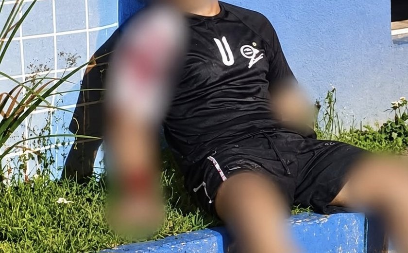 Adolescente sobrevive a dois tiros na cabeça e finge de morto para escapar em Maceió