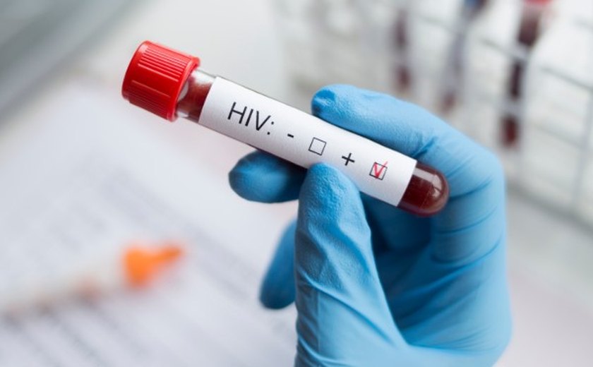 Cura do HIV: Cientistas anunciam quarto caso no mundo