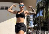 Personal trainer sofre AVC hemorrágico durante corrida e passa por cirurgia que removeu metade do crânio