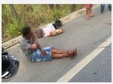 Homem perde a perna após acidente entre moto e carro em Murici
