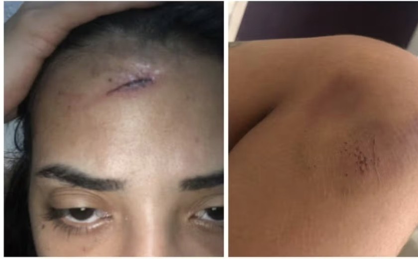 Jovem que esfaqueou namorado em Maceió relata histórico de agressões e perseguição