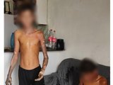 Adolescente ferido em explosão de fogos de artifício em Ibateguara teve 60% do corpo queimado