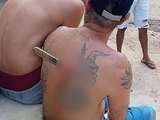Homem esfaqueado após discussão fica com faca cravada nas costas