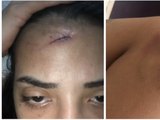 Jovem que esfaqueou namorado em Maceió relata histórico de agressões e perseguição