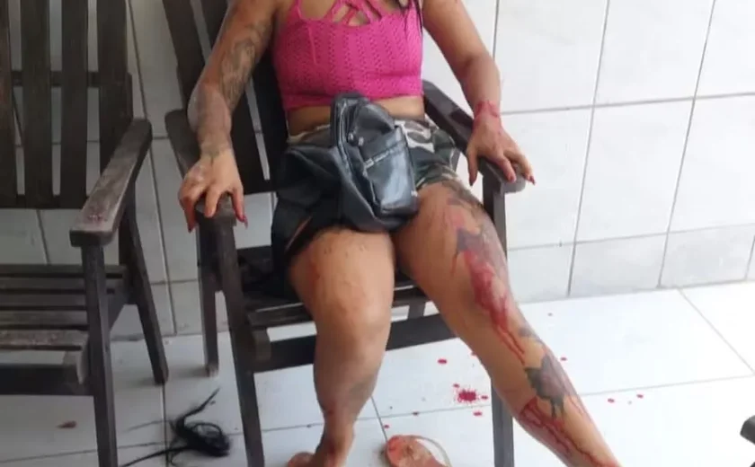 Mulheres fingem o próprio sequestro, mandam fotos de uma delas ferida e tentam extorquir R$ 50 mil de mãe aposentada