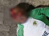Homem sofre acidente em São José da Laje e é socorrido