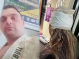 Lutador de jiu-jítsu espanca esposa após se irritar ao ser acordado
