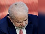 Médico de Lula diz que lesão de pele retirada da cabeça do presidente é comum e não trará restrições