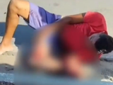 Acidente em Murici deixa homem gravemente ferido