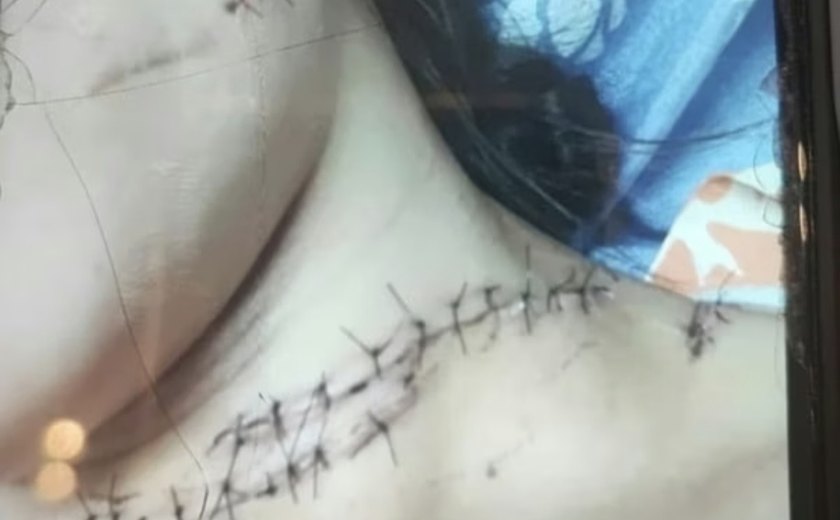 Homem é preso por tentar matar ex-companheira a facadas em Maceió