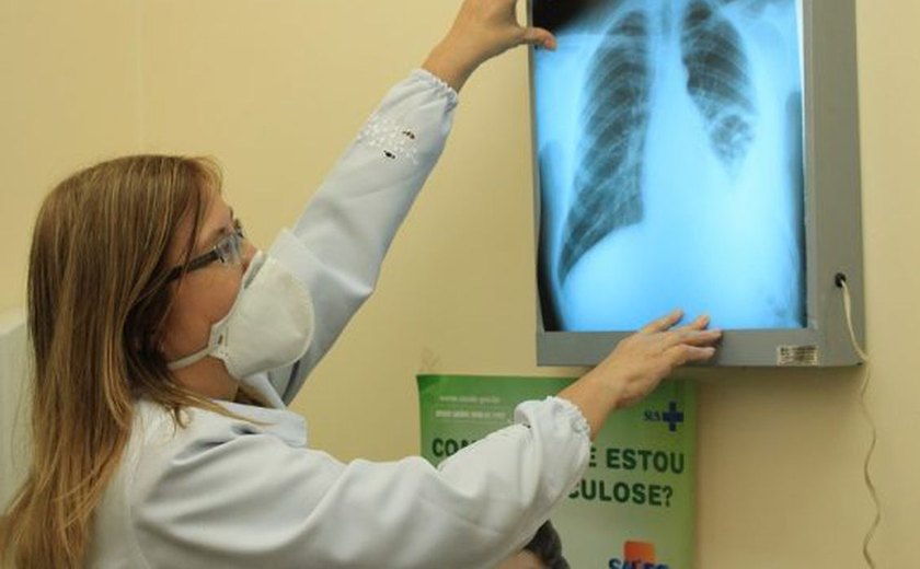 Governo cria comitê para eliminar a tuberculose