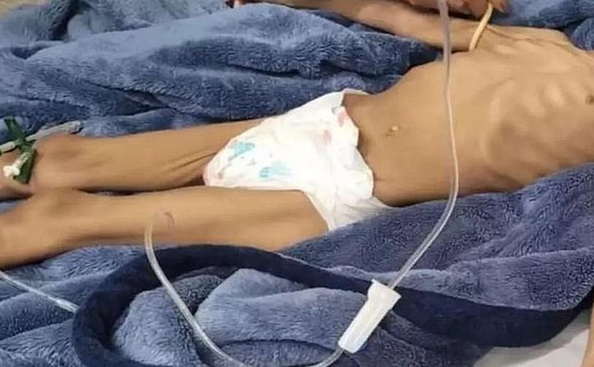 Menina de 3 anos resgatada após 40 dias sem comer tem alta de hospital