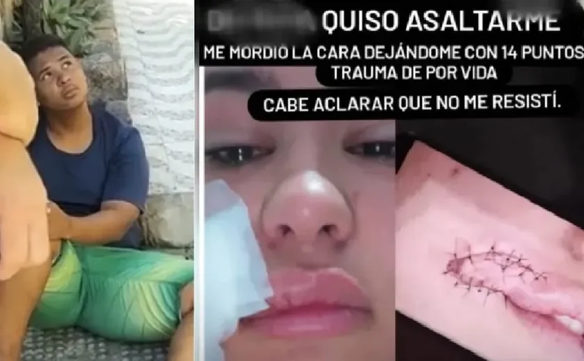 Jovem que mordeu rosto de turista paraguaia durante assalto em Maceió vira réu