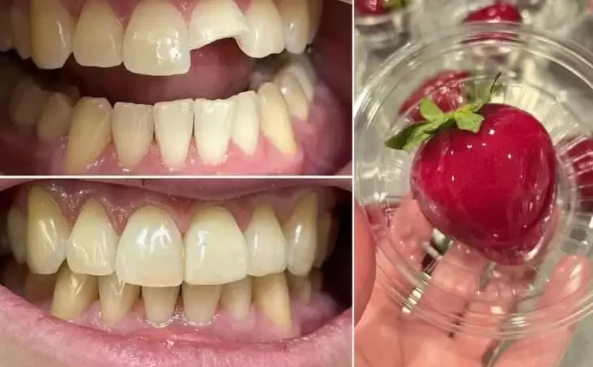 Dentistas alertam sobre riscos do ‘morango do amor’ para a saúde bucal; 7 casos de fraturas já foram registrados