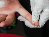SUS passa a oferecer teste rápido de dengue