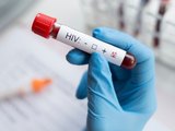 Cura do HIV: Cientistas anunciam quarto caso no mundo