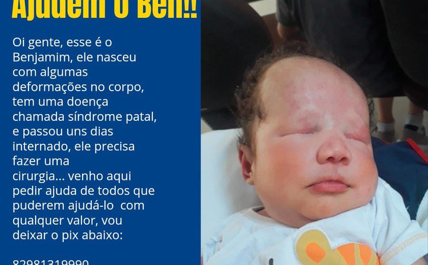 Família pede ajuda para bebê que necessita de cirurgia