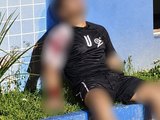 Adolescente sobrevive a dois tiros na cabeça e finge de morto para escapar em Maceió