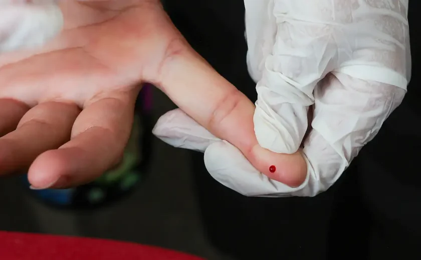 SUS passa a oferecer teste rápido de dengue