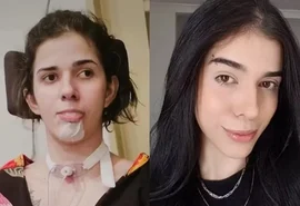 Caso de jovem que teve sequelas ao cheirar pimenta completa 3 anos