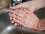 Três pessoas ficam com queimaduras após briga familiar em Cacimbinhas