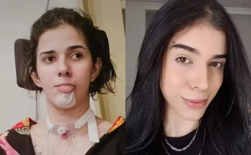 Caso de jovem que teve sequelas ao cheirar pimenta completa 3 anos