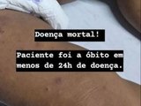 Meningite: Bebê morre no HGE menos de 24h após apresentar primeiros sintomas da doença