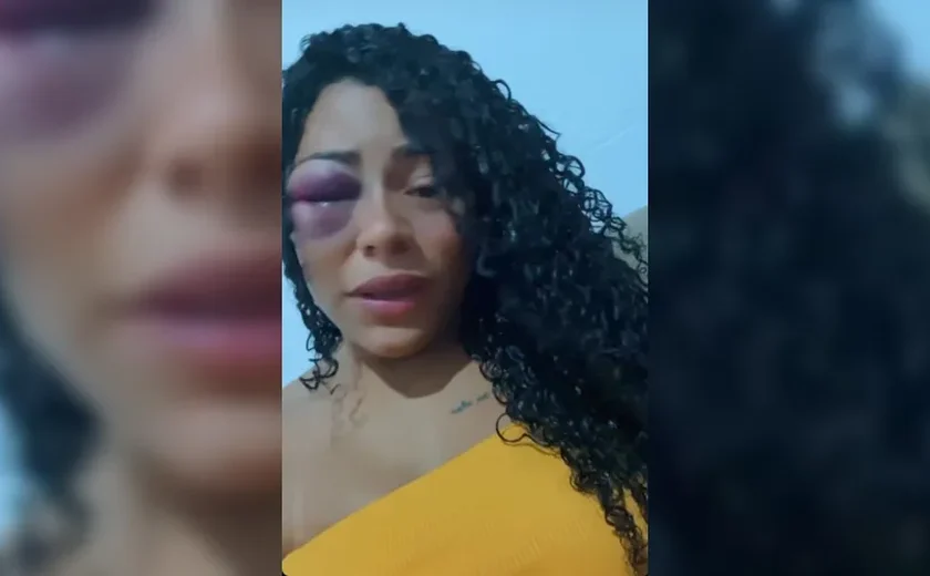 Aos prantos, dançarina expõe agressões de ex-companheiro nas redes