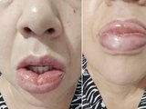 Mais de 1,2 mil pessoas relataram reação a pasta da Colgate; venda segue proibida