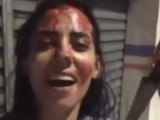 Mulher esfaqueia companheiro após agressões e é liberada por legítima defesa em Maceió